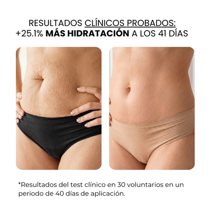 Tratamiento Anti Estrías | beauty™️
