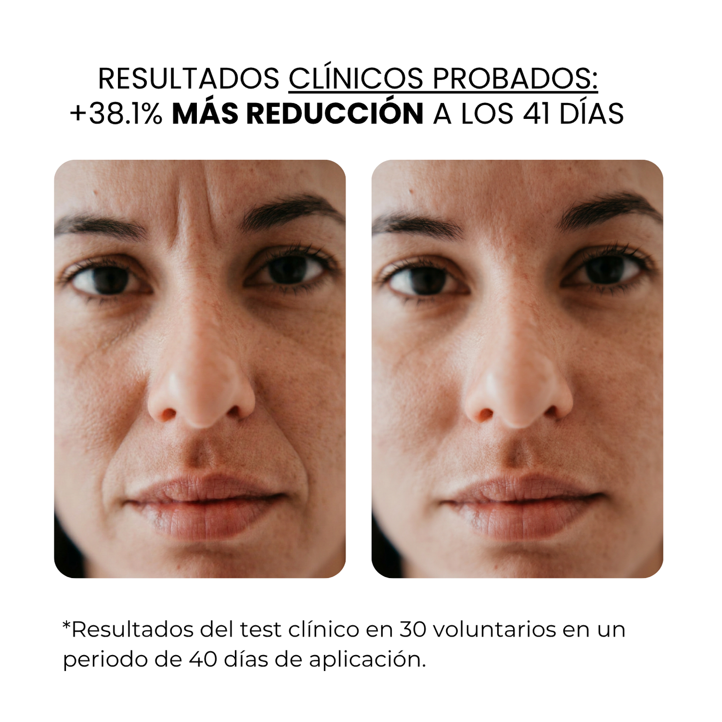 Tratamiento Anti Edad | beauty™️