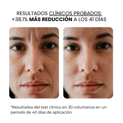 Tratamiento Anti Edad | beauty™️