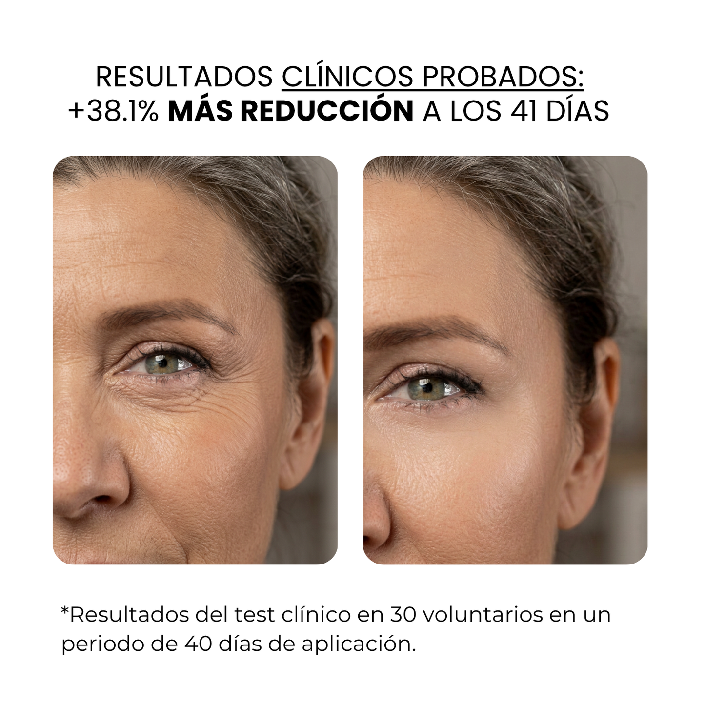 Tratamiento Anti Edad | beauty™️