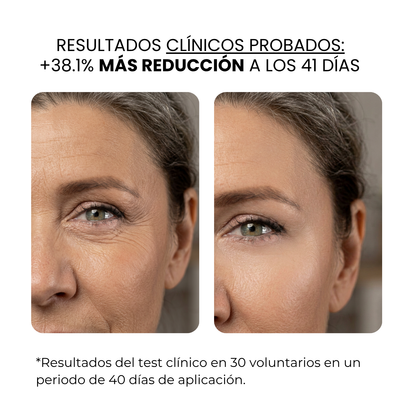 Tratamiento Anti Edad | beauty™️