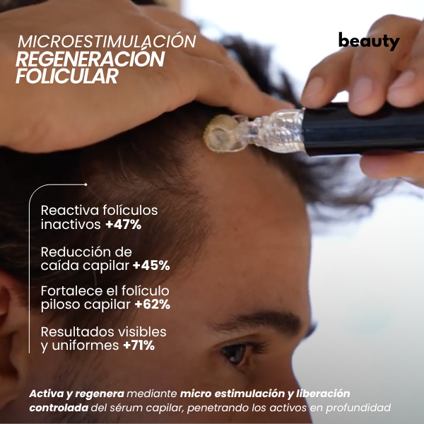 Crecimiento Capilar Masculino | beauty™️