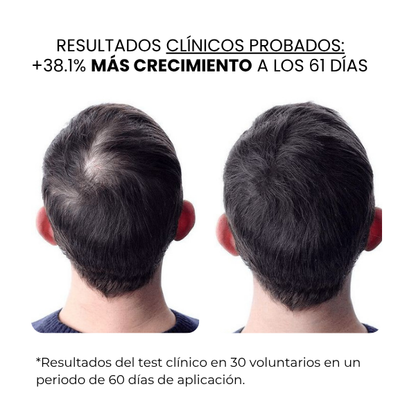 Crecimiento Capilar Masculino | beauty™️