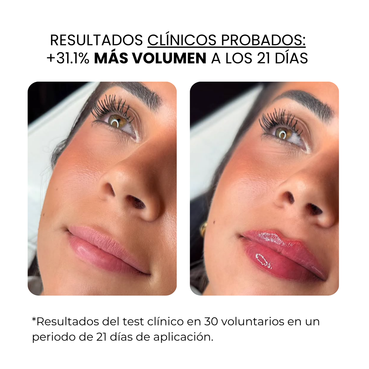 Tratamiento Labial | Beauty™️