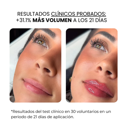 Tratamiento Labial | Beauty™️