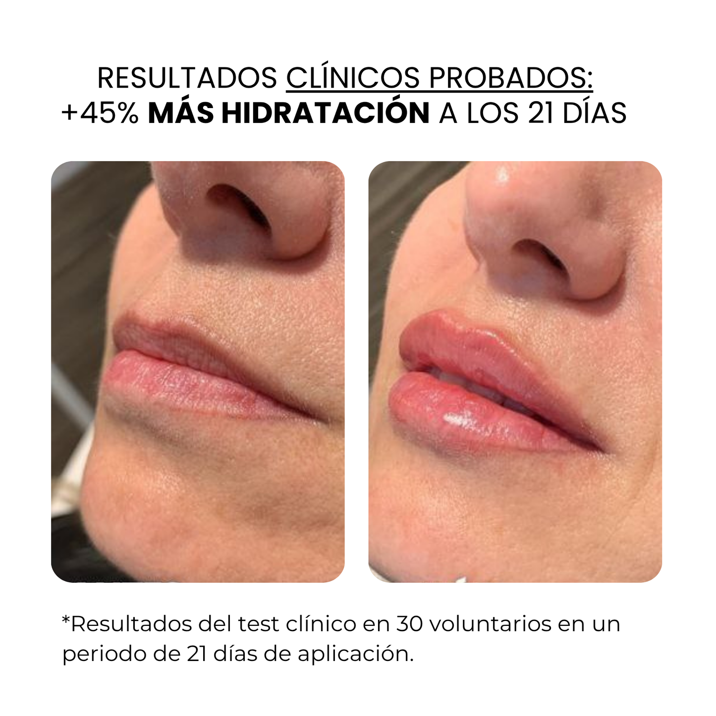 Tratamiento Labial | Beauty™️